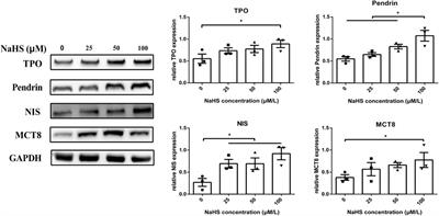 Hydrogen Sulfide Promotes Thyroid Hormone Synthesis and Secretion by Upregulating Sirtuin-1